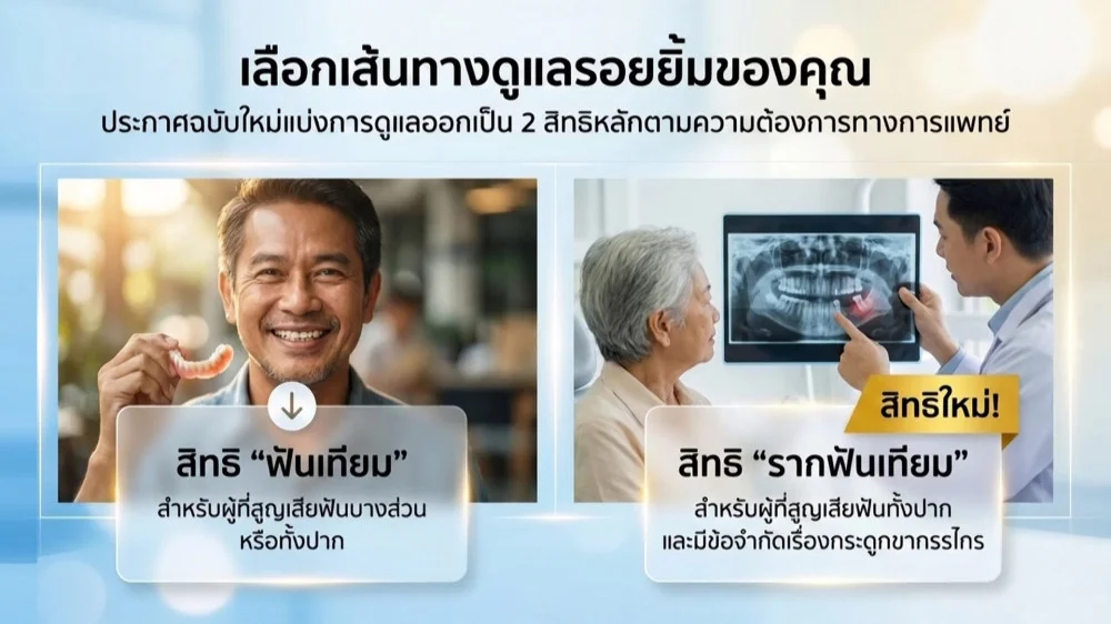 ราชกิจจา Digest ฉบับย่อย ตอน 50 |  ฟันปลอม รากฟันเทียม เบิกประกันสังคมได้ไหม? หลักเกณฑ์ใหม่ 2569