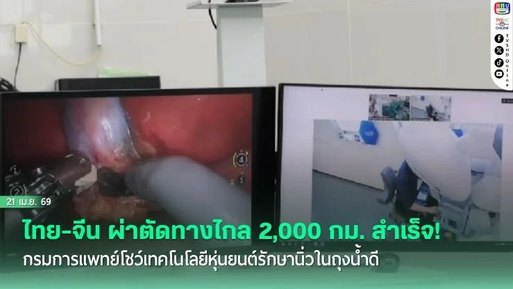 ไทย-จีน ผ่าตัดทางไกล 2,000 กม. สําเร็จ! กรมการแพทย์โชว์เทคโนโลยีหุ่นยนต์รักษานิ่วในถุงน้ําดี
