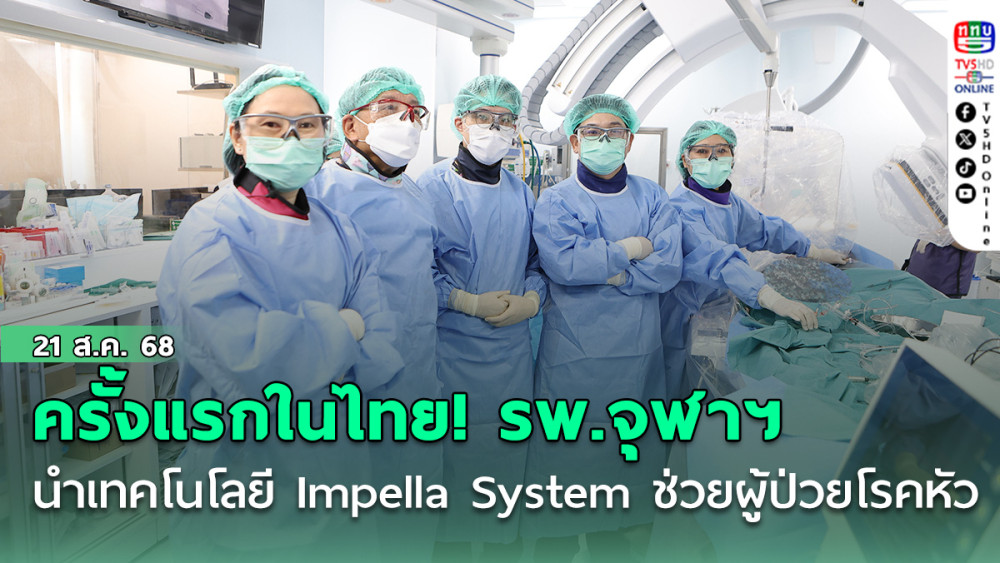 ครั้งแรกในไทย! รพ.จุฬาฯ นําเทคโนโลยี Impella System ช่วยผู้ป่วยโรคหัวใจ
