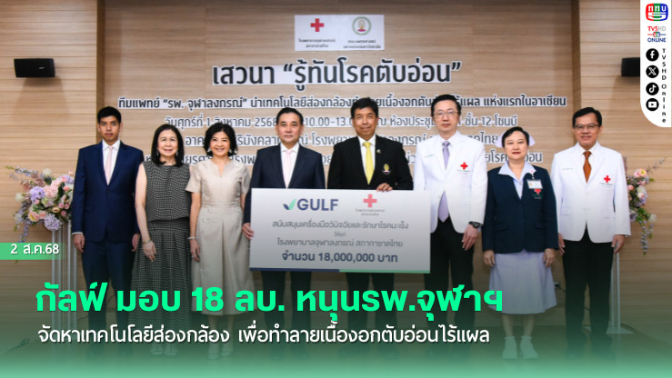 กัลฟ์ มอบ 18 ลบ. หนุนรพ.จุฬาฯ จัดหาเทคโนโลยีส่องกล้อง  เพื่อทำลายเนื้องอกตับอ่อนไร้แผล