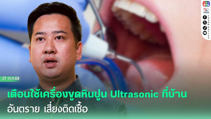เตือนใช้เครื่องขูดหินปูน Ultrasonic ด้วยตนเองที่บ้าน เสี่ยงทำลายฟันและเหงือก แนะใช้สิทธิ์บัตรทองขูดหินปูนฟรี