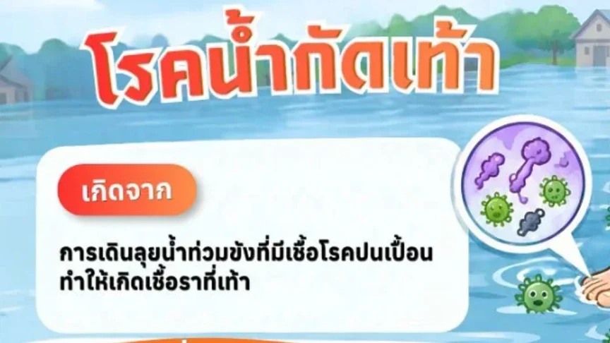 ลุยน้ำขังเสี่ยงเท้าเปื่อย! เช็กวิธีรับมือ “โรคน้ำกัดเท้า” ช่วงน้ำท่วม