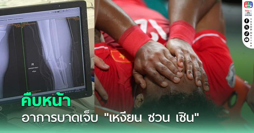 สื่อเวียดนามเผยอาการบาดเจ็บ "เหงียน ซวน เซิน" ดาวยิงตัวเก่ง