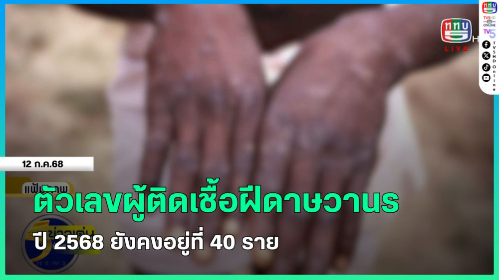 ตัวเลขผู้ติดเชื้อฝีดาษวานร ปี 2568 ยังคงอยู่ที่ 40 ราย