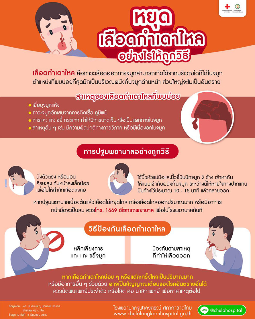 เลือดกำเดาไหล คือ ภาวะเลือดออกทางจมูก ตำแหน่งที่พบบ่อยที่สุด มักเป็นบริเวณผนังกั้นจมูกด้านหน้า