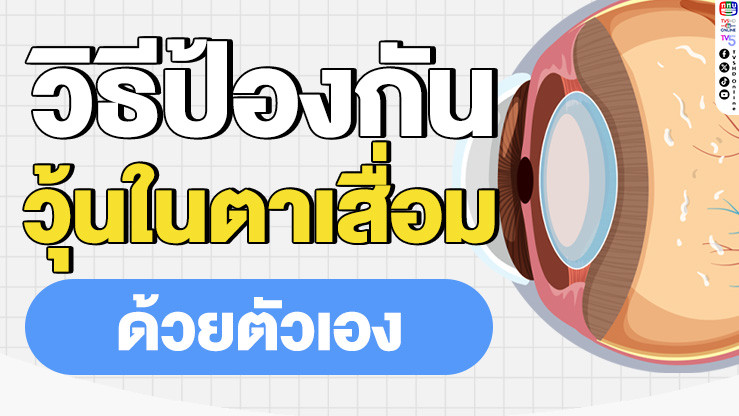วิธีป้องกันภาวะ "วุ้นในตาเสื่อม" ด้วยตัวเอง