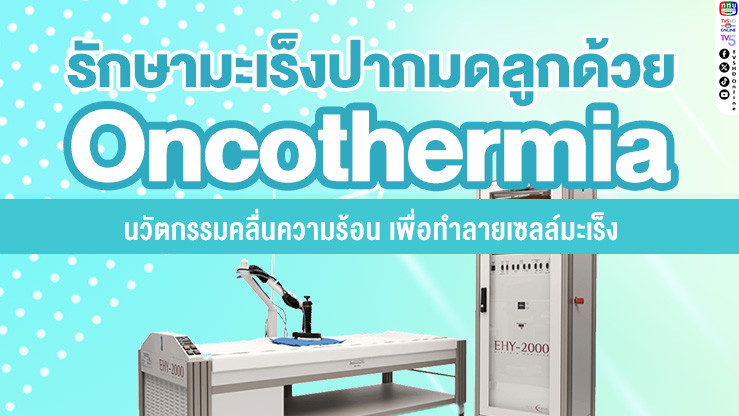 รักษามะเร็งปากมดลูกด้วย Oncothermia นวัตกรรมคลื่นความร้อน เพื่อทําลายเซลล์มะเร็ง