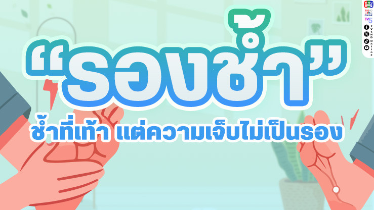 รู้จัก "รองช้ํา" ช้ําที่เท้า แต่ความเจ็บไม่เป็นรอง