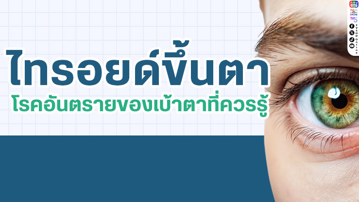 ตาโปน ตาแห้ง อย่ามองข้าม! “ไทรอยด์ขึ้นตา” โรคอันตรายที่หลายคนอาจไม่เคยรู้
