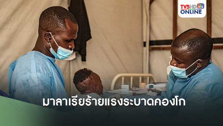 มาลาเรียร้ายแรงระบาดคองโก