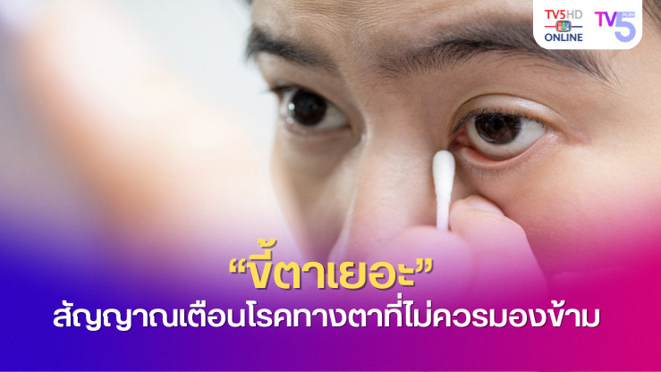 "ขี้ตาเยอะ" สัญญาณเตือนโรคทางตาที่ไม่ควรมองข้าม 