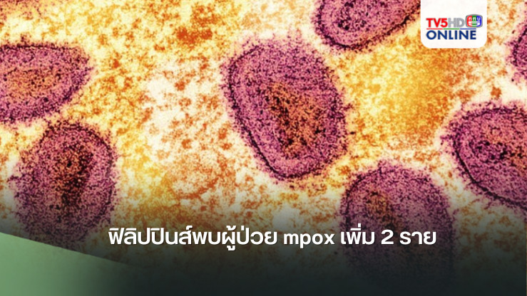 ฟิลิปปินส์พบผู้ป่วย mpox เพิ่ม 2 ราย
