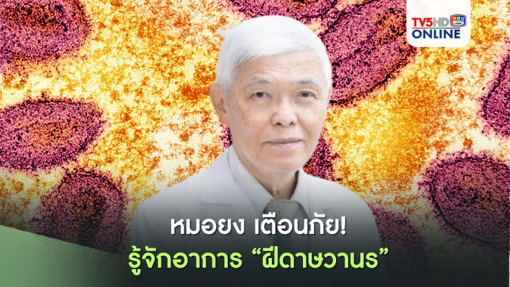 หมอยง เตือนภัย! รู้จักอาการ "ฝีดาษวานร" 