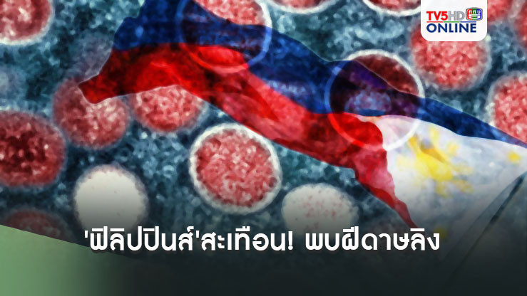 'ฟิลิปปินส์'สะเทือน! พบผู้ติดเชื้อไวรัส'ฝีดาษลิง'รายแรก ไม่มีประวัติเดินทางออกนอกประเทศ