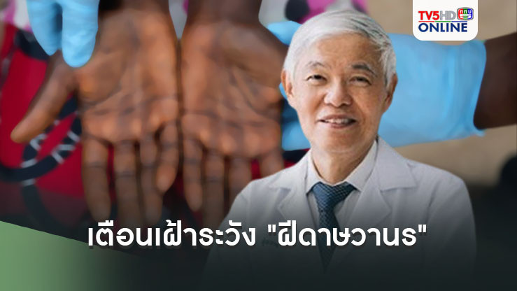 เตือนเฝ้าระวังการระบาดใหญ่