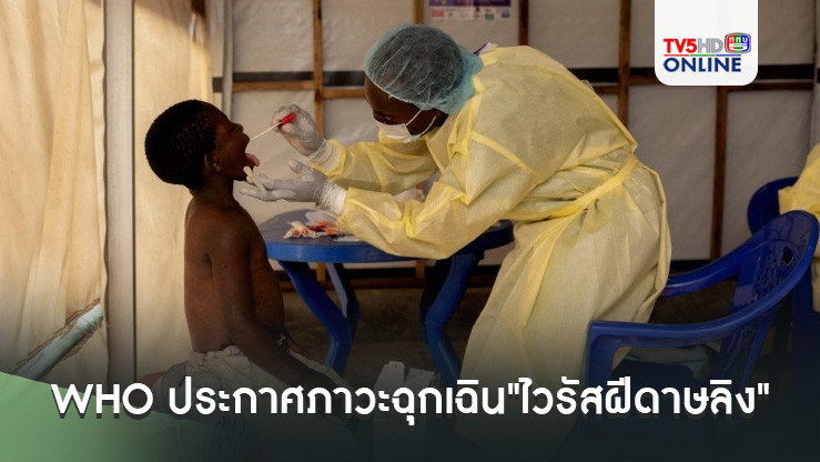 WHO ประกาศภาวะฉุกเฉินทั่วโลก "ไวรัสฝีดาษลิง"ในคองโก 