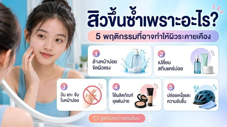 “สิวขึ้นซ้ำเพราะอะไร?” 5 พฤติกรรมใกล้ตัวที่อาจทำให้ผิวระคายเคือง