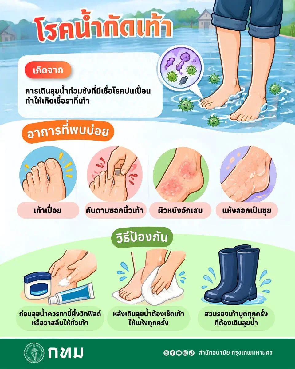 รูปภาพบทความ